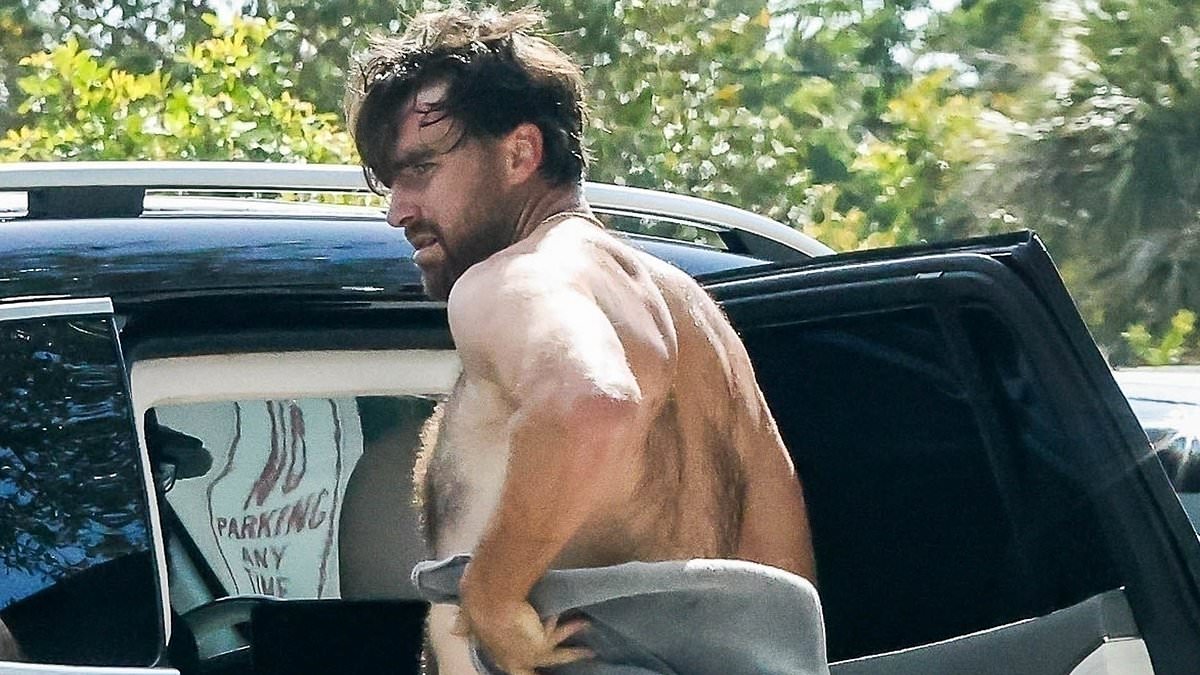 taylor-alert-–-travis-kelce-offered-solutions-for-his-‘hairy-as-s***’-back-after-viral-photos-sparked-concern-for-taylor-swift